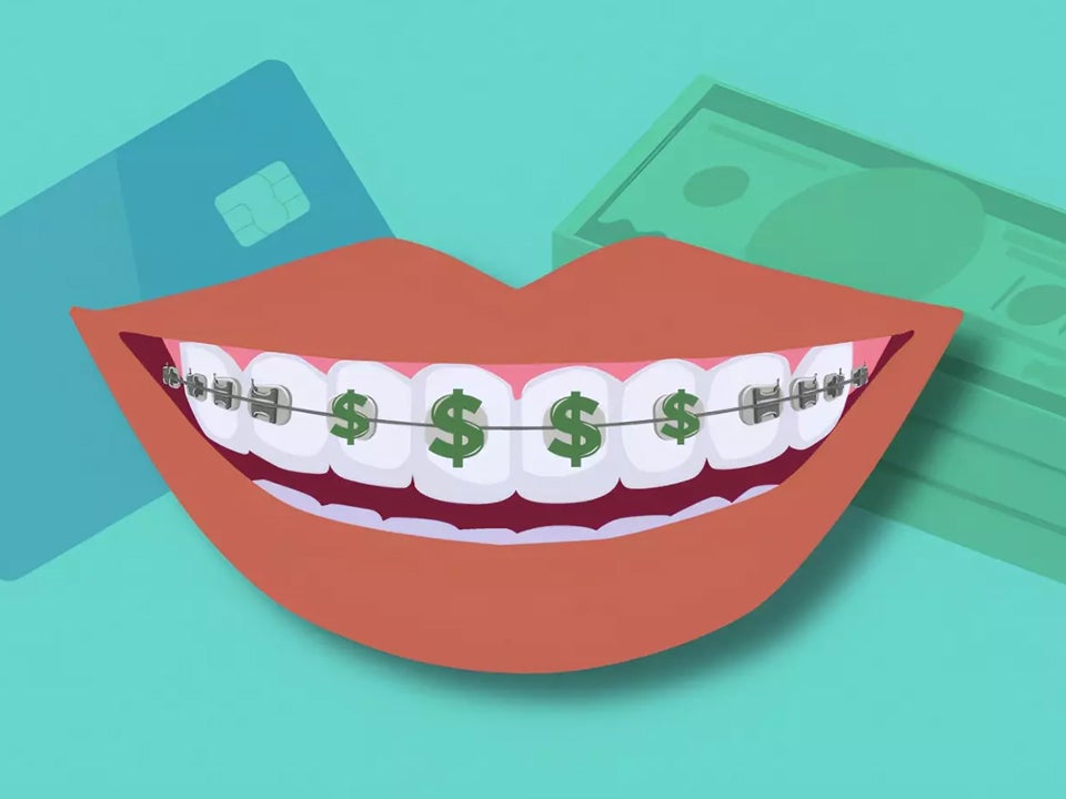 braces on teeth, with payment options in the background